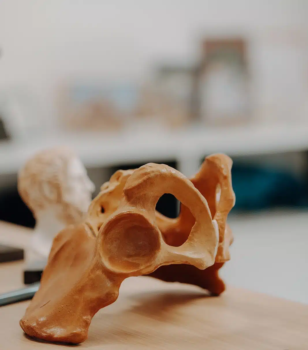 Spinalkanalstenose